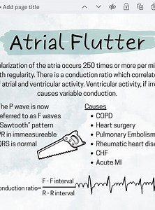 Atrial Rhythm Study Guide for Nursing Students - Etsy Canada