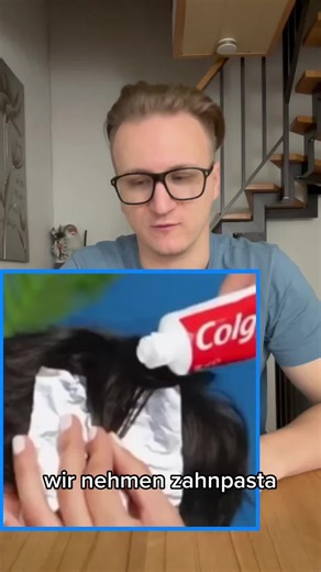 Effective Splinter Removal Method at Home