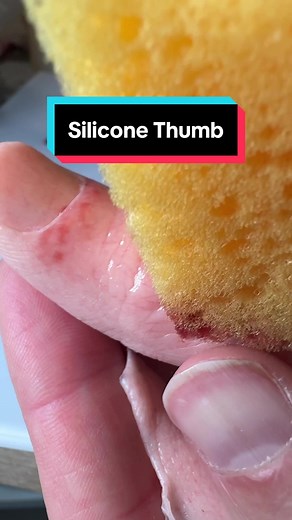Creating a Silicone Thumb Cover - DIY Tutorial