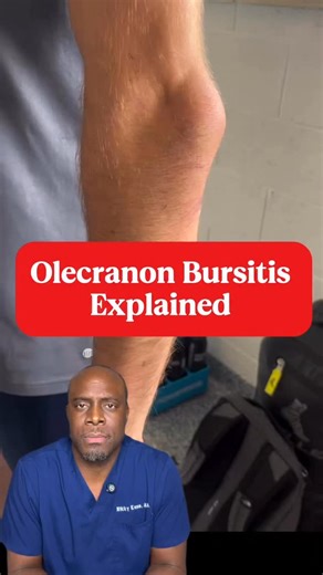 Zikky Kanu, M.D. on Instagram: "Big bump on the elbow? It might look scary, but it’s often a swollen bursa, not bone. Here’s why it happens and what it means. #ElbowBursitis #JointHealth #Radiology #MedEd #DrZikkyExplains Disclaimer:This content is for medical education purposes only and should not substitute for professional medical advice or care. Always consult a licensed healthcare provider regarding your specific situation."