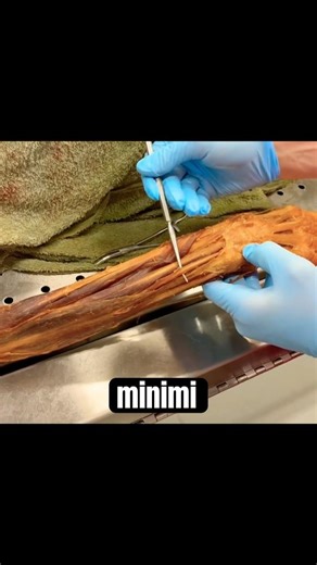 Extensor digiti minimi