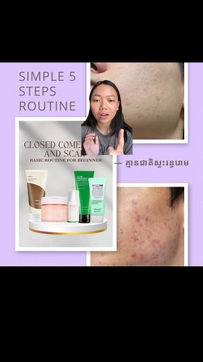 Ultimate Guide: 5 steps routine for Closed Comedones and Scar