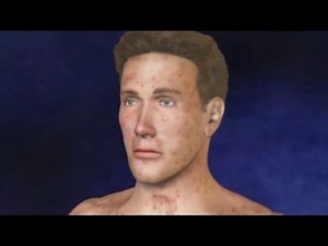 1.9K views · 37 reactions | Varicelle - symptômes, causes, traitements et prévention | Encyclopédie Médicale | Facebook