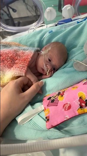 28 Weeks premature baby life journey🥺 #baby #premature #28weeksbaby #shortvideo #shorts #babyshorts