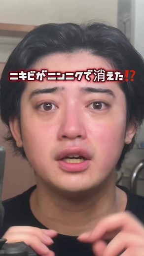 ニンニクでニキビ対策！皮膚科卒業のチャンス
