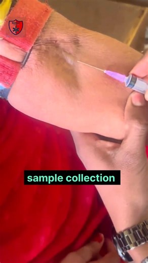 How to perform blood sampling || @robothealth