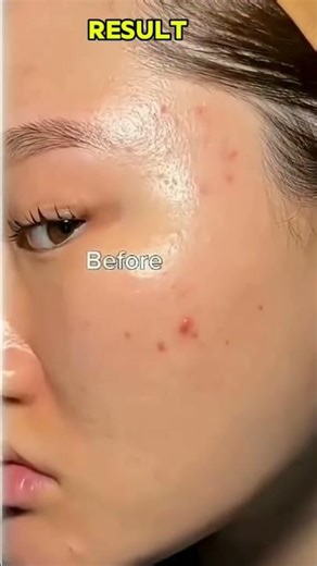 Korean glass skin at home 🌷#viralvideo #shortsfeed #skincare