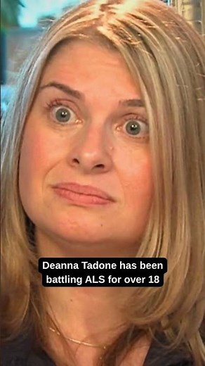 ALS TWITCHING CHARACTERISTICS‼️Living with ALS Hand, Leg & Tongue Muscle Fasciculations Symptoms