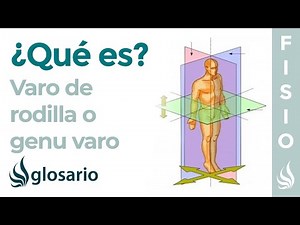 KNEE VARUUS | What it is, causes, symptoms, who it affects, and treatment