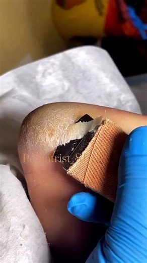 1. “Healthy feet, happy life. Pamper your toes—they carry you everywhere!” 2. “Say goodbye to dry heels and hello to baby-soft feet 👣✨” 3. “Your feet deserve the same care as your face—show them some love today 💅” 4. “Clean. Soft. Beautiful. Perfect feet start with proper care.” 5. “Feet care isn’t luxury—it’s self-respect 🦶💖” #feetcare #footcare #pedicure #selfcare #healthyfeet #footspa #softfeet #toecare #exfoliation #callusremoval #spafoot #beautycare #ladylashlounge #sanjosebeauty #nailc