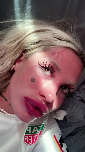 Хофманита против мира: Скандальная битва