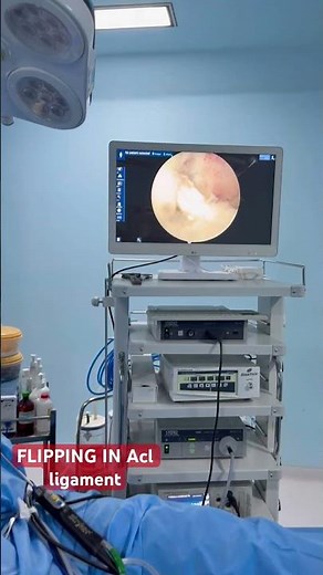 ACL ligament FLIPPING !!