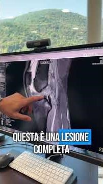 Cosa succede quando si rompe un crociato anteriore?