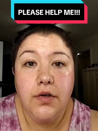 Please like, comment, and share. I have stage 3 lipedema and secondary lymphedema. I desperately need some surgeries to help with the pain, but they are not covered by insurance. This video went viral once. Maybe we can do it again. #lipedema #lymphedema #viralvideo #viral #pleasegoviral