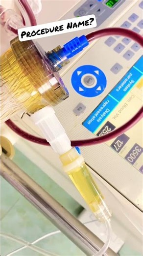 Removal Of Plasma From Blood Procedure Name? #nephrology #uvteam #dialysis #ndt #plasmapheresis #abo