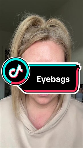 Effective Eye Creams for Mature Skin and Eye Bags