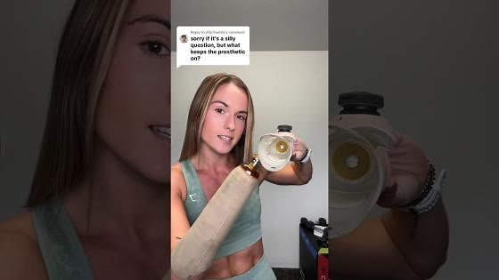 How My Prosthetic Stays Attached to My Arm � A Motivational Journey!