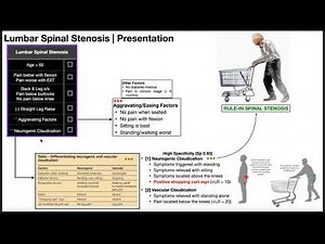 Lumbar Spinal Stenosis | Presentation & Diagnosis