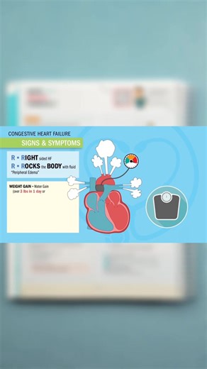 12K views · 152 reactions | Let's review HF with our study  . . . #nursing #study #studyguide | Simple Nursing | Facebook