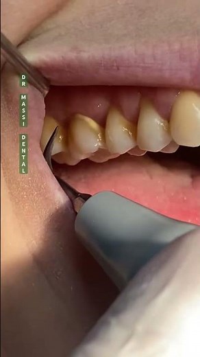 ✨Nothing beats the confidence of shiny, healthy teeth! 😁✨
