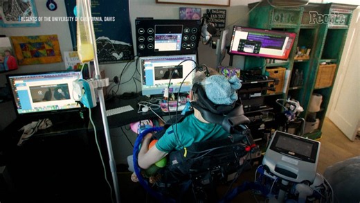 ALS patient, 47, gains ability to speak and sustain full-time job using experimental brain-computer interface