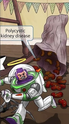 🧠 Ace USMLE genetics by diving deep into Patau Syndrome (Trisomy 13)