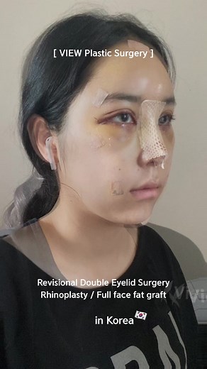 Transformation through Korean Plastic Surgery