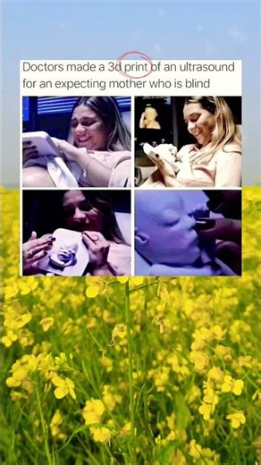 Doctors made a 3d print of an ultrasound for an expecting mother who is blind