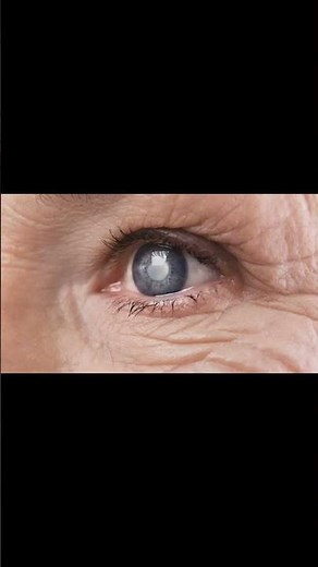 What are the symptoms of pseudoexfoliation?