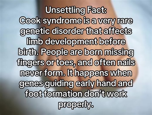 Understanding Cook Syndrome: A Rare Limb Development Disorder