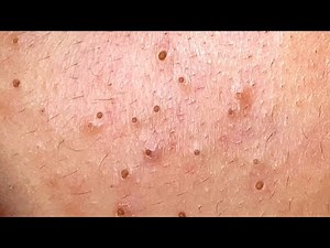 Relax Every Day With Sac Dep Spa #0208