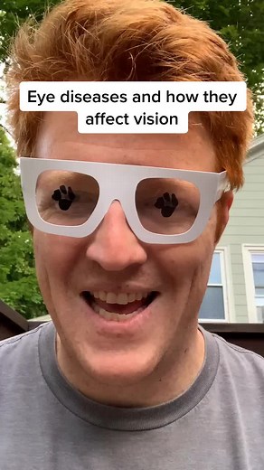 Different Eye diseases #instructorfortheblind #teachersoftiktok #learnontiktok #blind #simulation #fyp #awareness