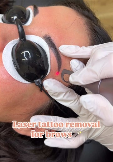 Effective Brow Tattoo Removal for a Softer Look