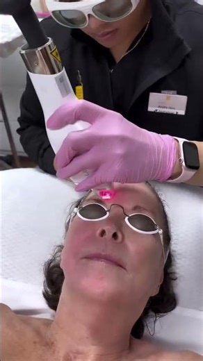 No more dull skin days with the Ultra laser.