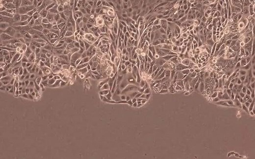 显微镜下肾脏上皮细胞迁徙中