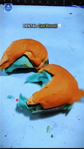 Dental Impression Opening 😳 Satisfying Cast Reveal | Dental Lab Work