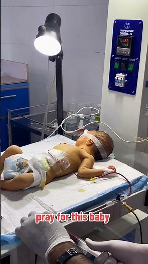 Critical Baby Life-Saving Blood Exchange | NICU Story