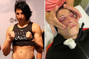 Female fighter Gutierrez shares pic of facial injuries after Serrano beating