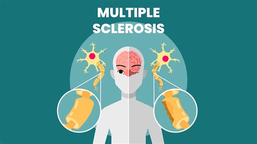 Dealing With Multiple Sclerosis? Here Are 7 Natural Remedies To Manage It