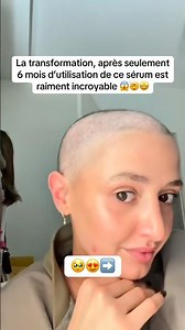 Ce sérum m’a sauvé mes cheveux 🤯😱😍 #cheveux #chutedecheveux #poussecheveux #viral