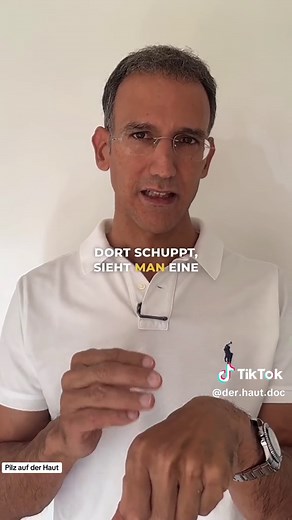 Kleiflechte: Eine häufige Hautpilzerkrankung