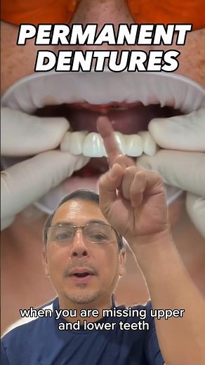 Implant Retained Denture EXPLAINED | In Office to Hands On Dental Training #shorts