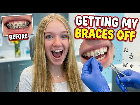 Trinity Gets Her Braces Off!!