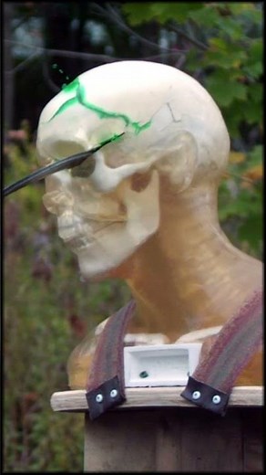 Historical Sickle Combat Would Be... Sick.