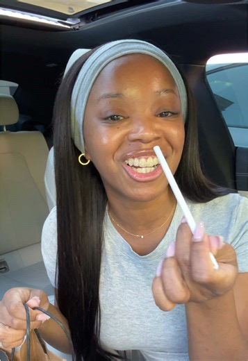 My Journey to a Perfect Smile: Invisalign Update