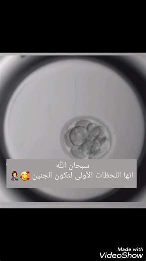 🔴🔴من بويضة إلى جنين 🔴🔴 ♦️جمع البويضات :تبدأ العملية بتنشيط المبايض للحصول على أكبر عدد ممكن من البويضات بعد ذلك يتم استخراج البويضات الناضجة. ♦️تلقيح البويضات :يتم تلقيح أو حقن كل بويضة واحدة بحيوان منوي واحد تحت المجهر (icsi) بعد اختيار الحيوان المنوي الافضل ♦️الانقسامات الاولى : خلال 24 إلى 48 ساعة الاولى تبدأ البويضة الملقحة بالانقسام و تكوين خلايا جديدة ♦️مرحلة الكيسة الاريمية : blastocyste بعد 5 إلى 6 ايام يصبح الجنين جاهز للنقل أو التجميد في حالة عدم الارجاع . ♦️عدد الاجنة المرجعة: يتم