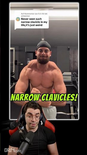 Overdeveloped TRAPS? 🤯👀