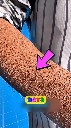 Why Your Skin Gets Tiny Bumps 😳