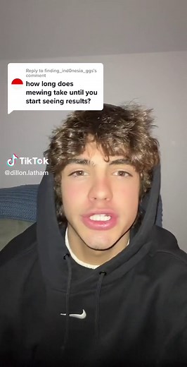 Understanding Mewing: Does it Really Improve Your Jawline?