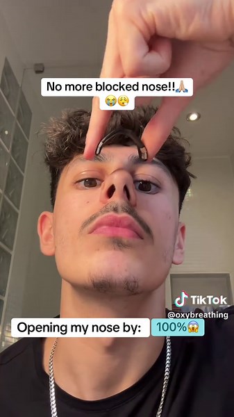 Blocked Nose Relief: Easy Hacks to Unclog Your Stuffy Nose